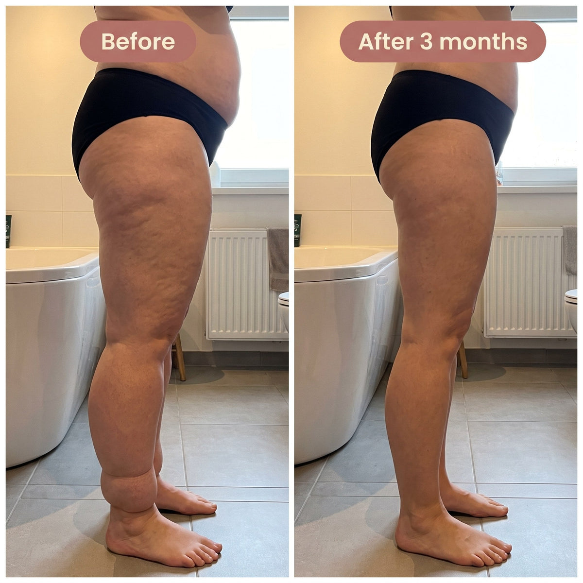 Maneele 4D Lipedema Leggings