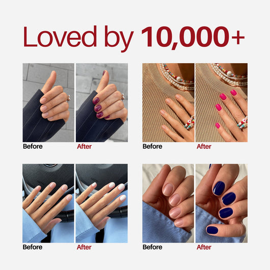 Sweenly Chocolate Nail Pen — loved by 10,000+ customers, before and after results